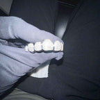 Moissanite Grillz (Custom Mold)