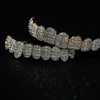 Set of grillz fully covered in sparkling stones and gold‑tone metal.