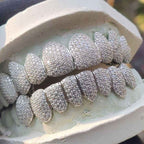 Moissanite Grillz (Custom Mold)