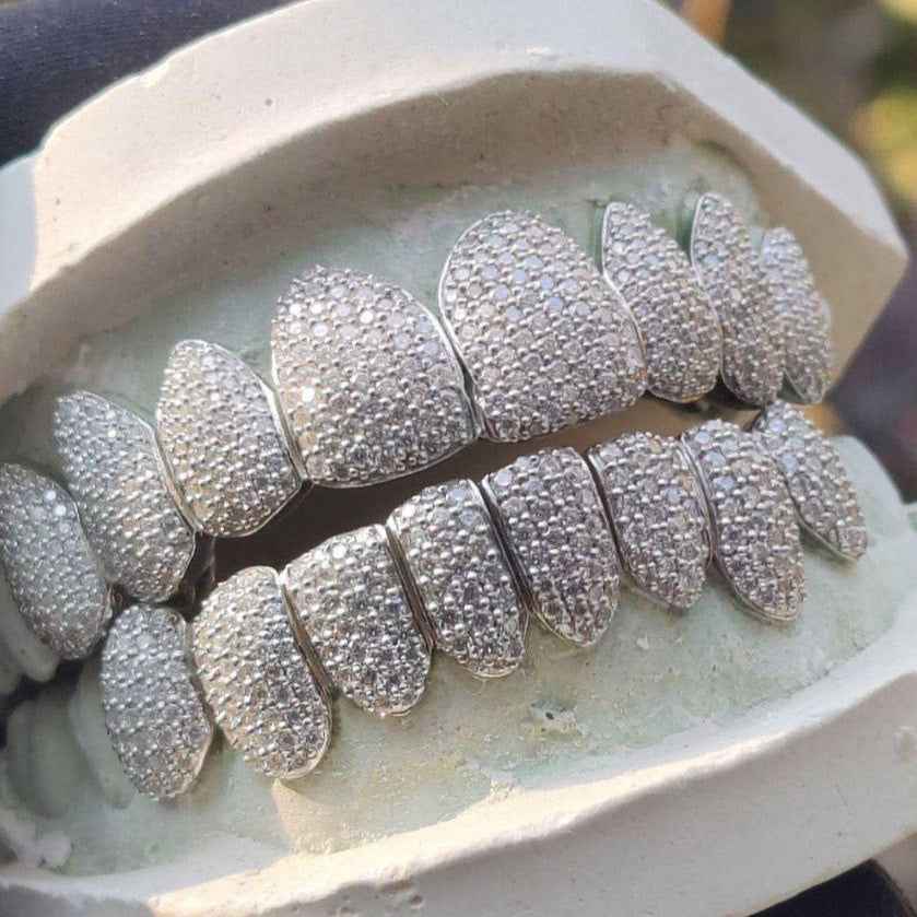 Moissanite Grillz (Custom Mold)